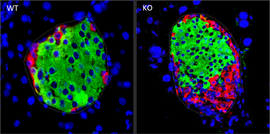 Murine pancreatic islets with and without SGLT1 knockout