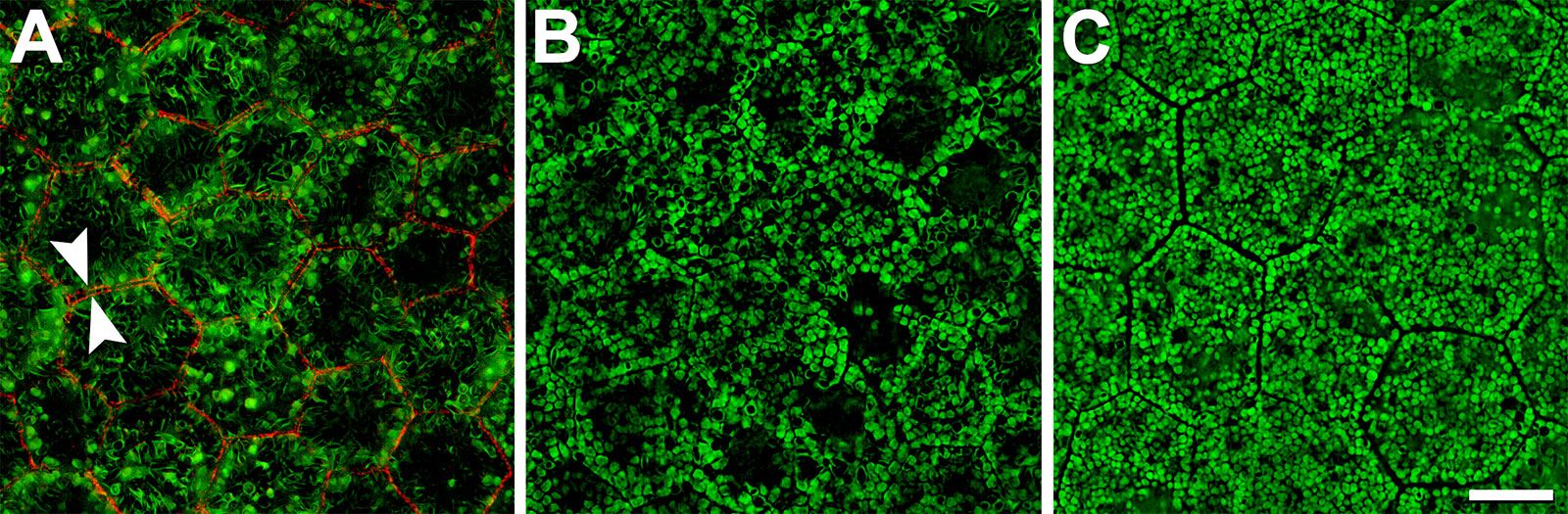 Autofluorescence of RPE cells; from: Ach et al: Investigative ophthalmology & visual science 56 (5), 3242-3252. Abbildung einer Autofluoreszenz von RPE-Zellen