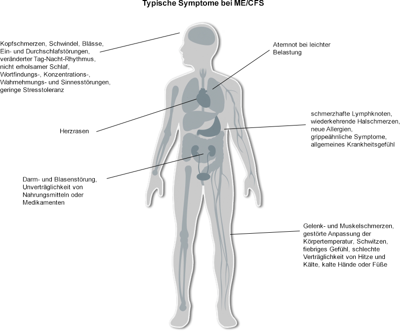 Das Schaubild zeigt den Körper eines Mannes mit schematisch eingezeichneten Organen. Den Organen und Körperteilen sind die Symptome der ME/CFS zugeordnet: Kopfschmerzen, Schwindel, Blässe, Ein- und Durchschlafstörungen, veränderter Tag-Nacht-Rhythmus, nicht erholsamer Schlaf, Wortfindungs-, Konzentrations-, Wahrnehmungs- und Sinnesstörungen, geringe Stresstoleranz, Herzrasen, Darm- und Blasenstörung, Unverträglichkeit von Nahrungsmitteln oder Medikamenten, Atemnot bei leichter Belastung, schmerzhafte Lymphknoten, wiederkehrende Halsschmerzen, neue Allergien, grippeähnliche Symptome, allgemeines Krankheitsgefühl, Gelenk- und Muskelschmerzen, gestörte Anpassung der Körpertemperatur, Schwitzen, fiebriges Gefühl, schlechte Verträglichkeit von Hitze und Kälte, kalte Hände oder Füße