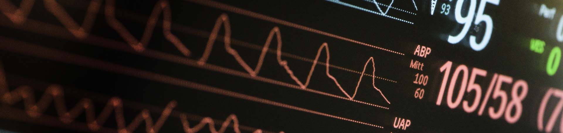 Anästhesie und Narkose, Bild: J-Brugger Illustrationsbild: Monitor mit Herzsequenzen
