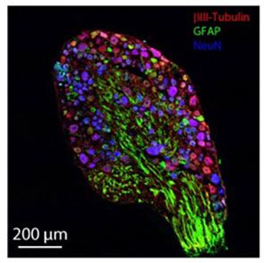 Immunhistochemie des Hinterwurzelganglions mit Expression von neuronalen und glialen Markern