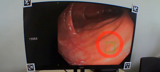 Eye Tracking Eye Tracking