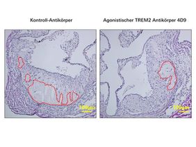 Agonistischer TREM2-Antikörper mit atheroprotektiver Funktion