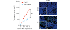 Die Grafik zeigt das Wachstum von Prostatakarzinomzellen mit und ohne Behandlung mit dem SQLE-Hemmstoff Terbinafin.