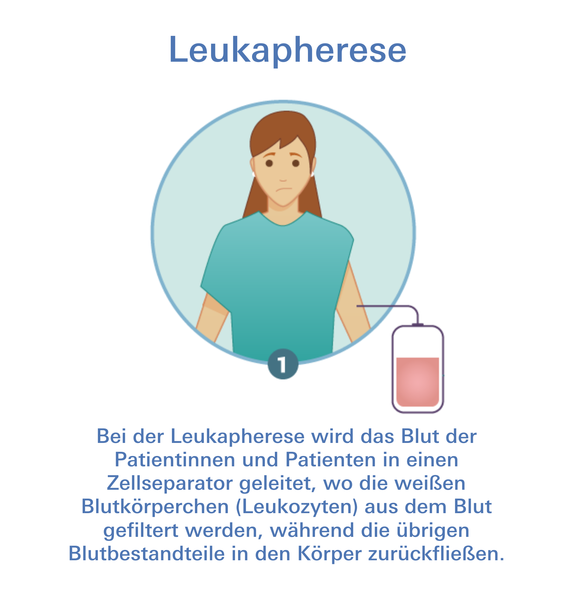 CAR-T-Zelltherapie Leukapherese