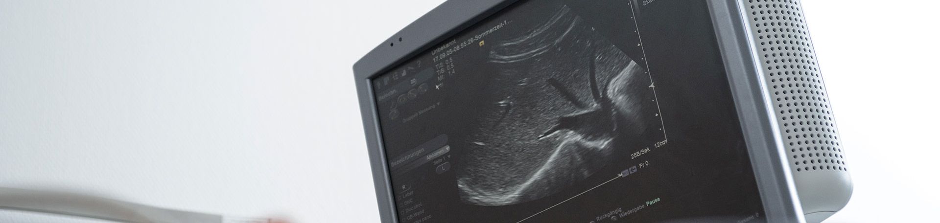 Bild von Ultraschallaufnahme