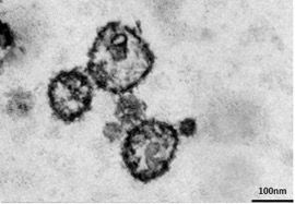 Elektronenmikroskopische Analyse von Exosomen im Blut Aufnahme einer elektronenmikroskopischen Analyse von Exosomen im Blut