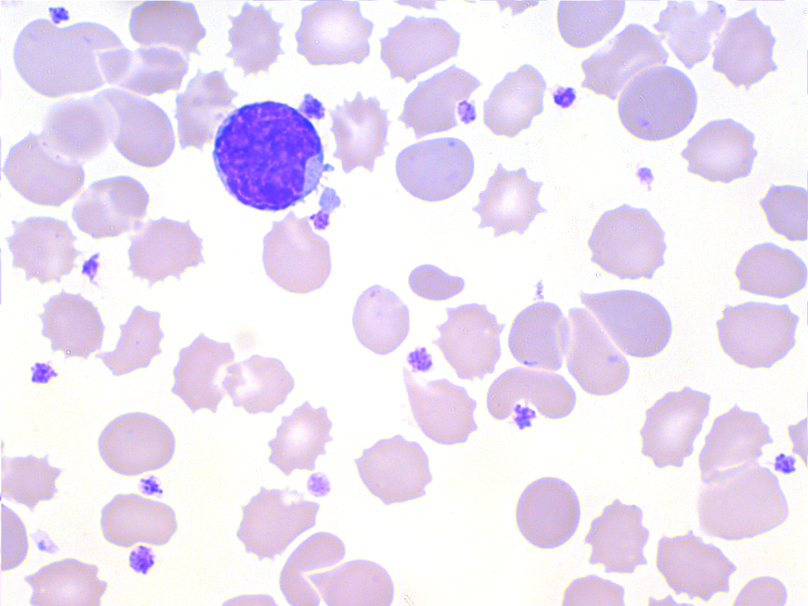 Blutausstrich Auf dem Bild sieht man rote Blutkörperchen neben violett angefärbten Blutplättchen