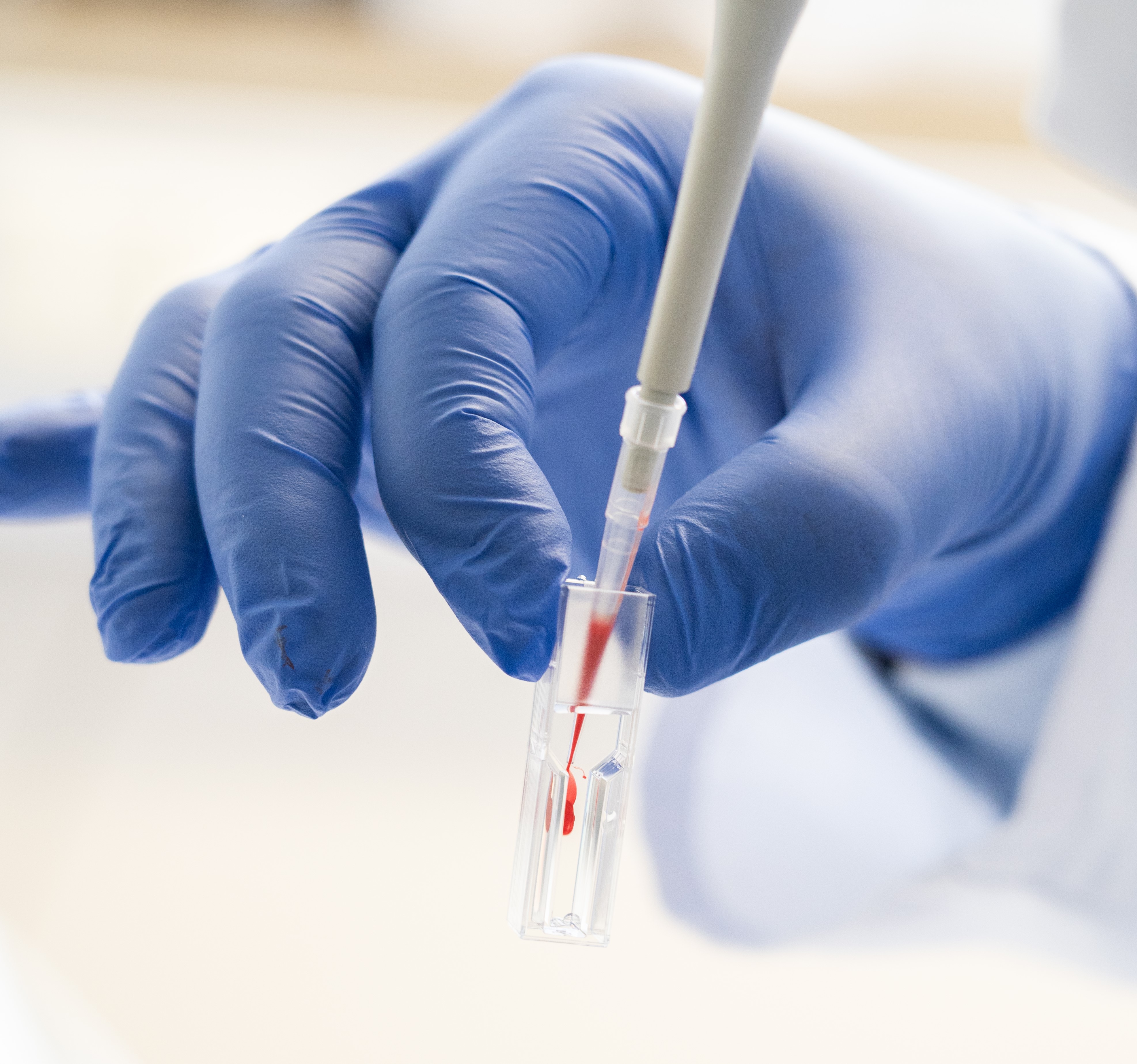Blutprobe Eine Hand mit blauem Handschuh bereitet mit einer Pipette eine Blutprobe vor.