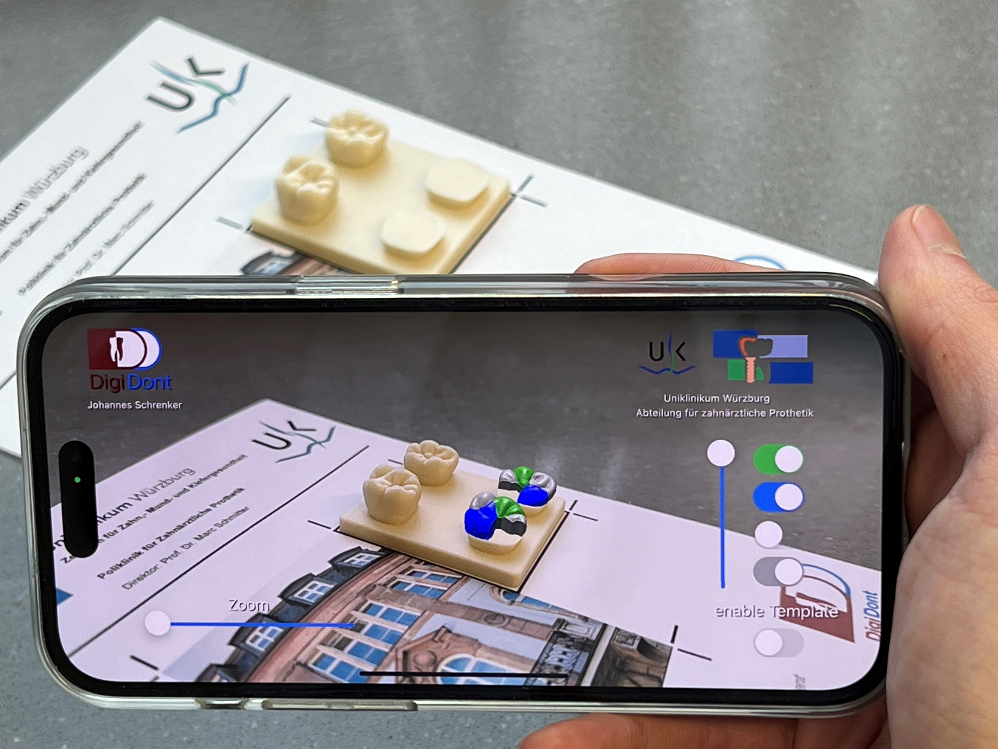 Preiswürdiges Lehrmittel: Die DigiDont-App erlaubt Studierenden durch Augmented Reality eine Kontrolle ihrer Wachsmodelle bei sogenannten Aufwachsübungen Bild der DigiDont-App