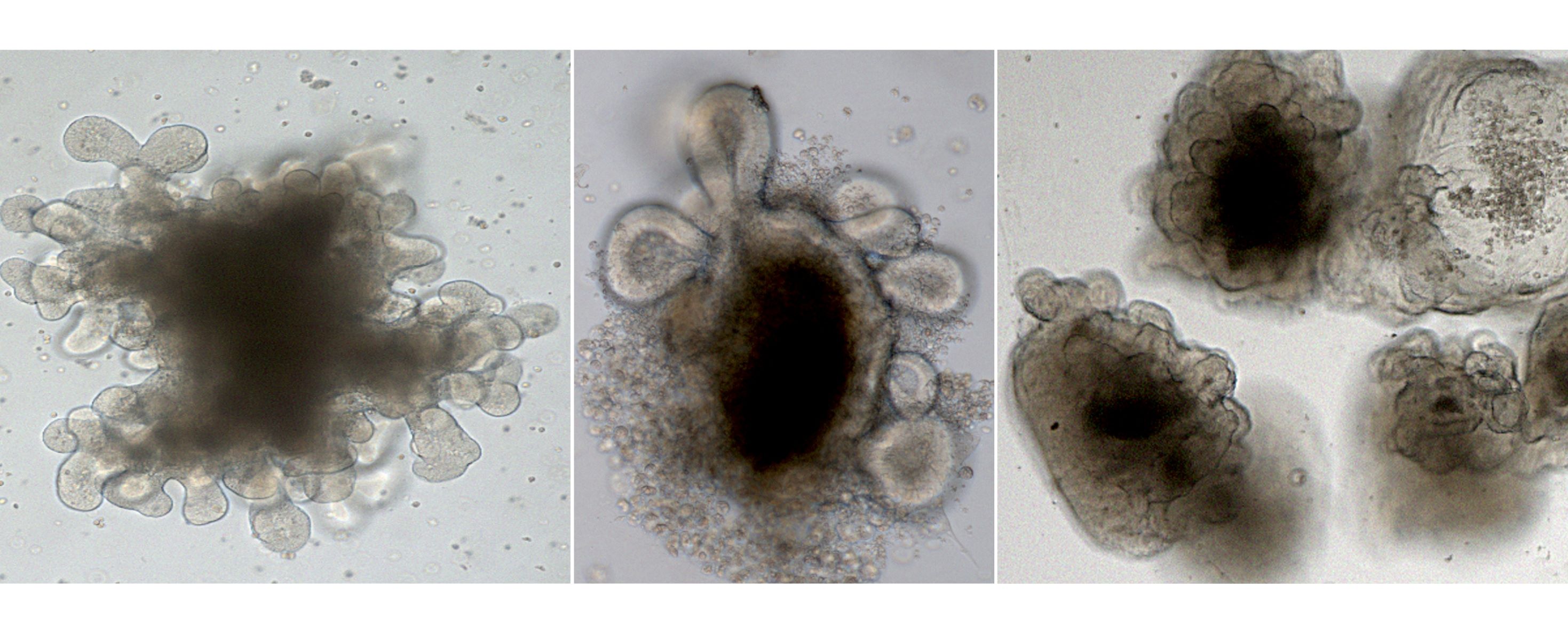 Organoide Collage aus drei mikroskopischen Bildern von Organoiden.